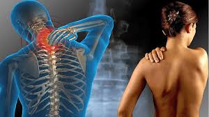 Cómo Vivir con Fibromialgia